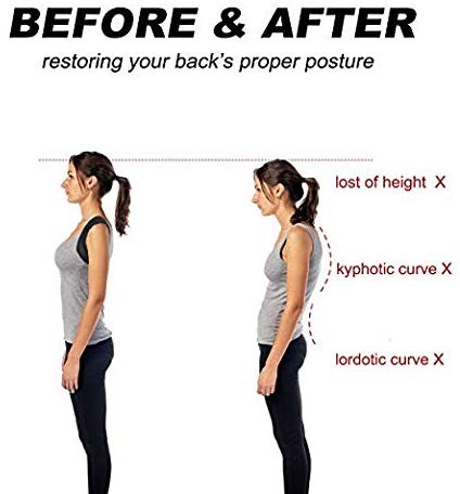 Posture corrector